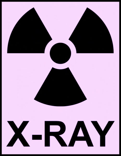 Radiation insignia above the work "X-ray" 