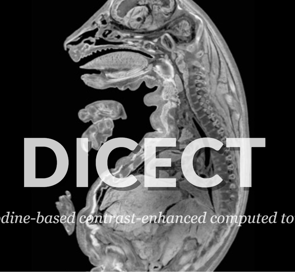 diceCT: Diffusible Iodine-based Contrast-enhanced Computed Tomography